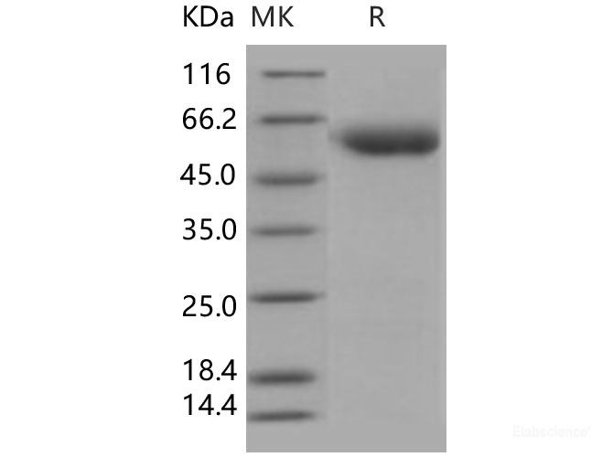 Recombinant Human SerpinA7 / TBG Protein (His tag)-Elabscience