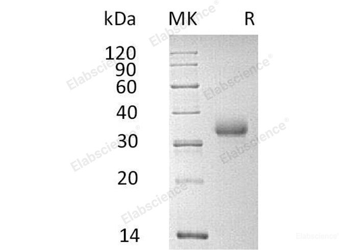 Recombinant Human CD2 Protein (His Tag)-Elabscience