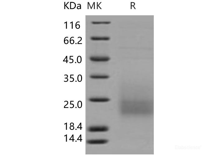 Recombinant Human CD3d / CD3 delta Protein (His tag)-Elabscience