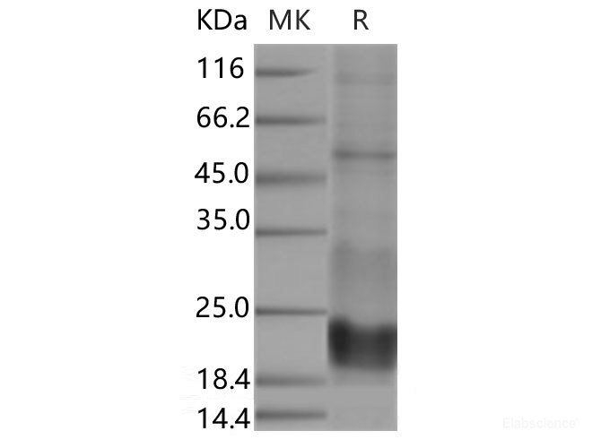 Recombinant Human CD3 epsilon / CD3e Protein (His Tag)-Elabscience