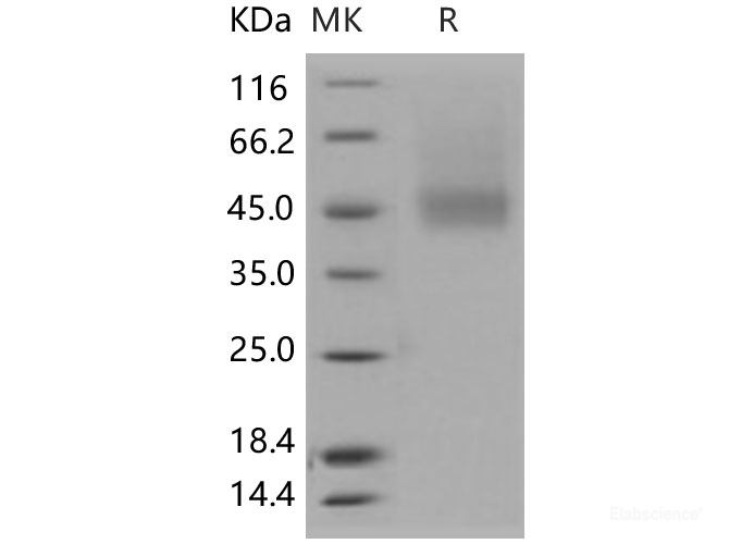 Recombinant Human IL7RA / CD127 Protein (His tag)-Elabscience