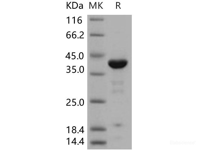 Recombinant Human ACP1 / LMW-PTP Protein (GST tag)-Elabscience