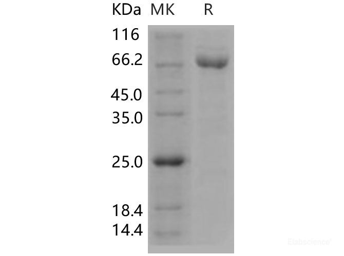 Recombinant Human A2M / CPAMD5 / Alpha-2-macroglobulin Protein (His tag)-Elabscience