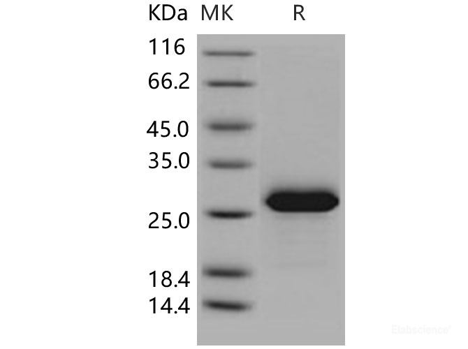Recombinant Human MESDC2 / MESD Protein (His tag)-Elabscience