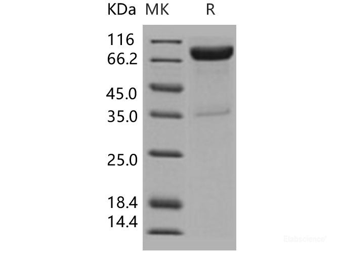 Recombinant Human IL10Rb Protein (His & Fc tag)-Elabscience