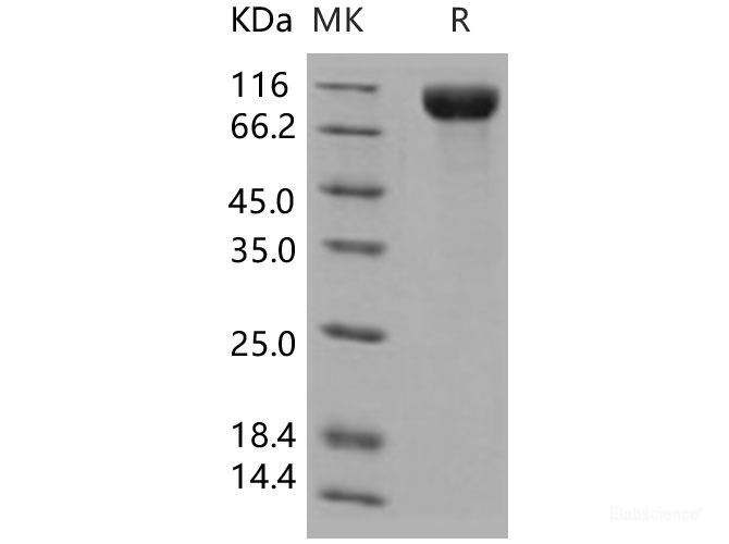 Recombinant Human IL13RA1 Protein (His & Fc tag)-Elabscience