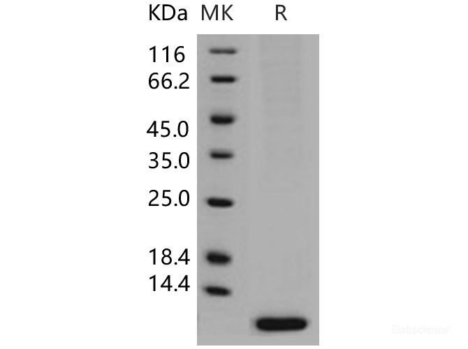 Recombinant Human S100A6 / CACY Protein (His tag)-Elabscience