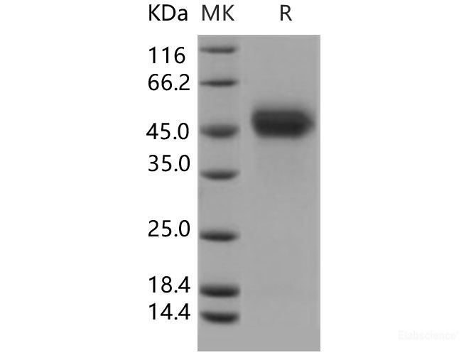 Recombinant Human uPAR / CD87 Protein (His tag)-Elabscience