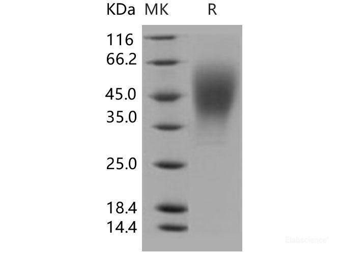 Recombinant Human OSTM1 Protein (His tag)-Elabscience
