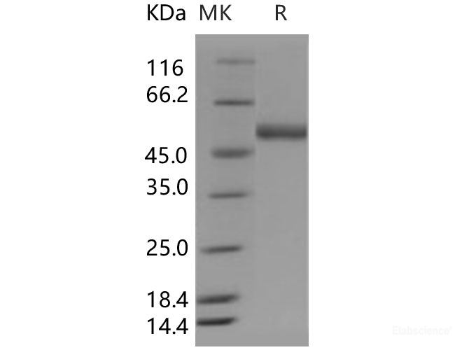 Recombinant Human ENTPD3 / NTPDase3 / CD39L3 Protein (His tag)-Elabscience
