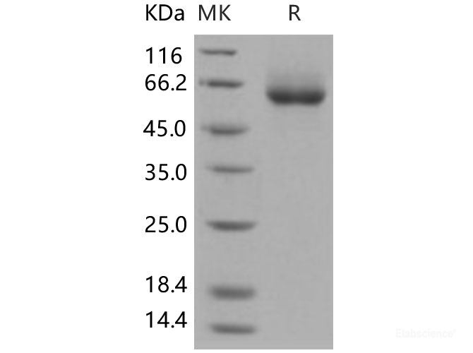 Recombinant Human ENPP7 / NPP-7 Protein (His tag)-Elabscience