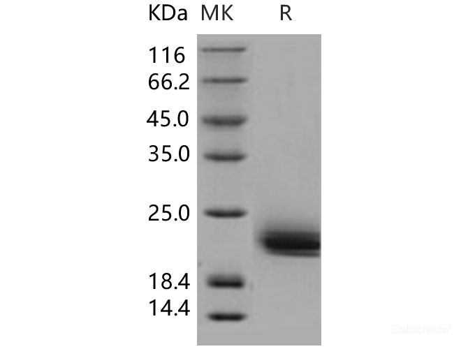 Recombinant Human LAIR2 / CD306 Protein (His tag)-Elabscience