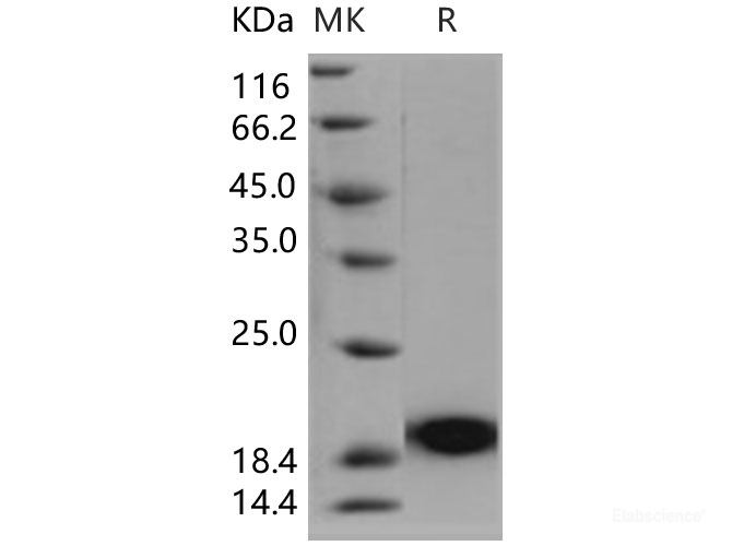 Recombinant Human PLA2G1B / PLA2 Protein (His tag)-Elabscience