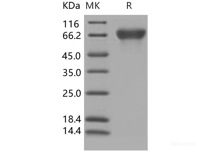 Recombinant Human CD113 / Nectin-3 / PVRL3 Protein (His tag)-Elabscience