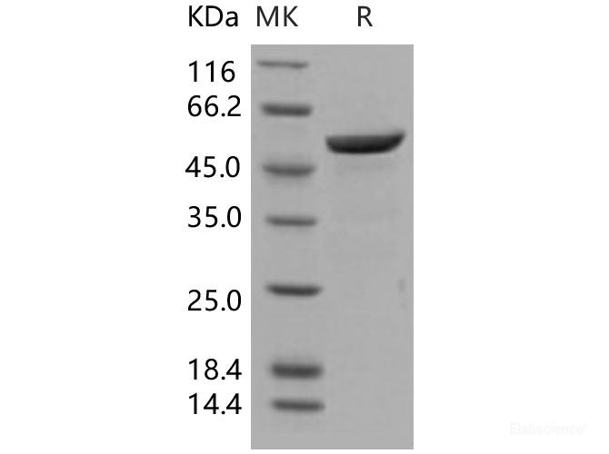Recombinant Human 14-3-3 beta / YWHAB Protein (GST tag)-Elabscience