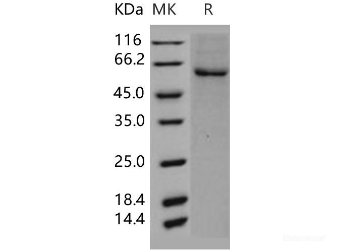 Recombinant Human GRK5 / GPRK5 Protein (His tag)-Elabscience