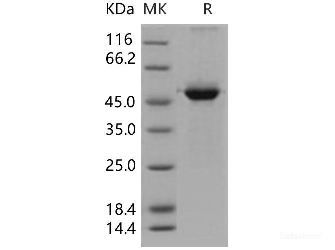 Recombinant Human 14-3-3 sigma / Stratifin / YWHAS Protein (GST tag)-Elabscience