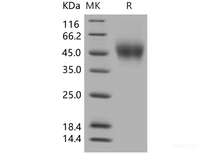 Recombinant Human CD150 / SLAM / SLAMF1 Protein (His tag)-Elabscience