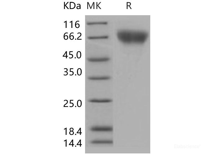 Recombinant Human FGFR2 / CD332 Protein (His tag)-Elabscience