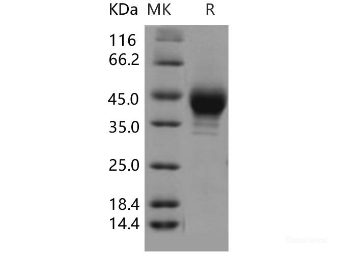 Recombinant Human SCARB3 Protein (His & FLAG tag)-Elabscience