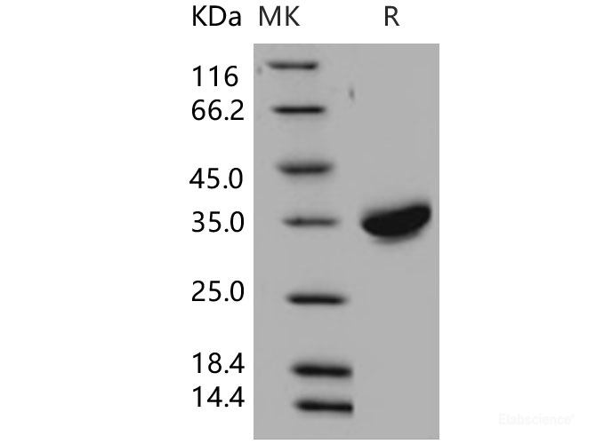 Recombinant Human CXADR / CAR Protein (His tag)-Elabscience