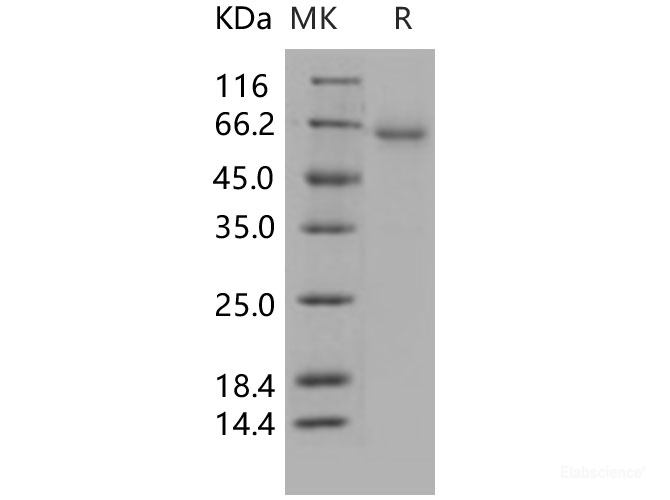 Recombinant Human CXADR / CAR Protein (His & Fc tag)-Elabscience
