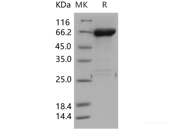 Recombinant Human JNK1 / MAPK8 Protein (GST tag)-Elabscience