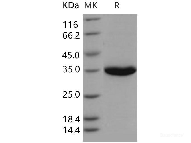 Recombinant Human KLK3 / PSA / Kallikrein-3 Protein (His tag)-Elabscience