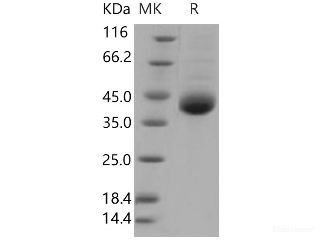 Recombinant Human Kallikrein 11 Protein (His Tag)-Elabscience