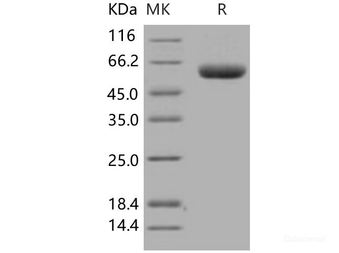Recombinant Human DPP7 / DPPII / DPP2 Protein (His tag)-Elabscience