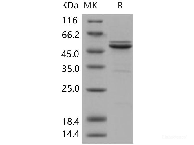 Recombinant Human JNK2 / MAPK9 Protein (His tag)-Elabscience