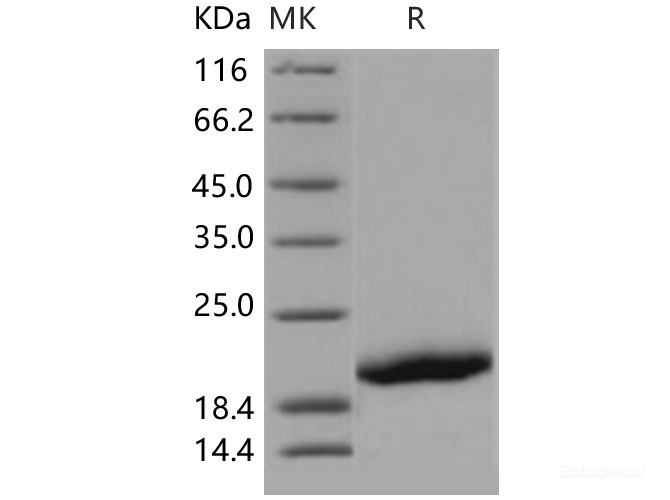 Recombinant Human GP1BB / CD42c Protein (His tag)-Elabscience