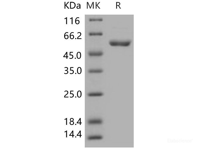 Recombinant Human CDC2 Kinase / CDK1 Protein (GST tag)-Elabscience