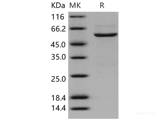 Recombinant Human CDK4 Protein (GST Tag)-Elabscience