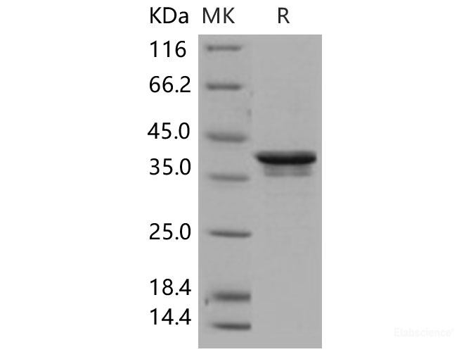 Recombinant Human PDK / PDZ binding kinase / TOPK Protein (His tag)-Elabscience