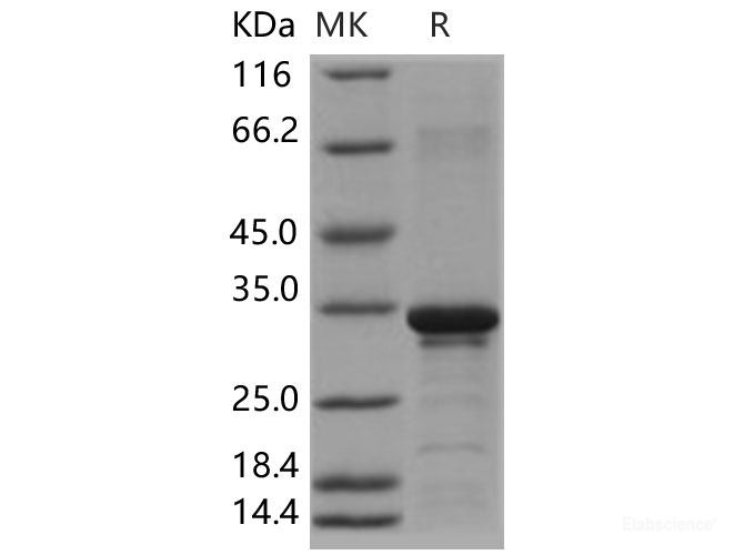 Recombinant Human Beta-amyloid 38 / Beta-APP38 Protein (aa 672-709, His & GST tag)-Elabscience