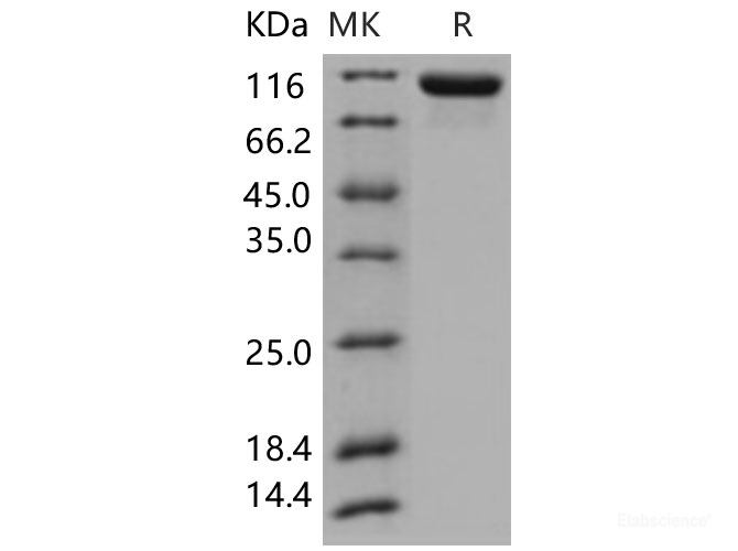 Recombinant Human Tie2 / CD202b / TEK Protein (His tag)-Elabscience
