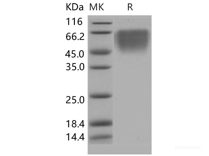 Recombinant Human CD86 / B7-2 Protein (His tag)-Elabscience