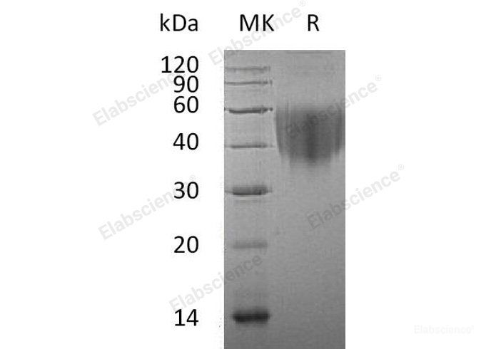 Recombinant Human B7-1 Protein-Elabscience