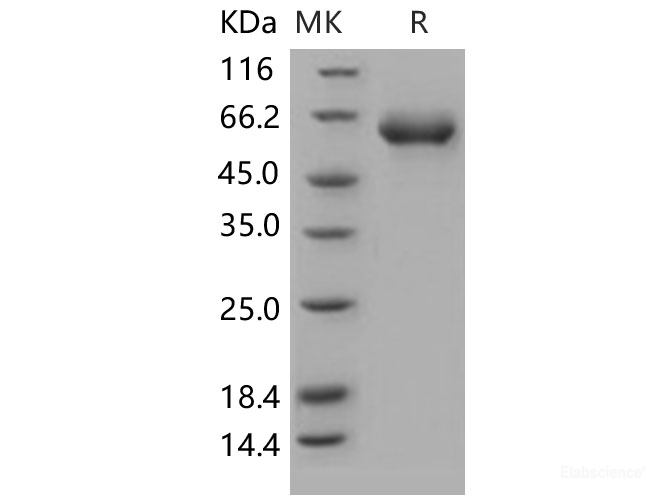 Recombinant Human CD122 / IL-2RB Protein (Fc tag)-Elabscience