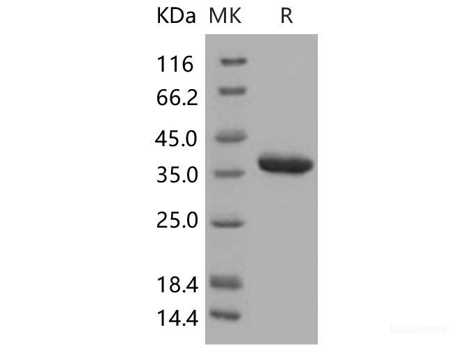 Recombinant Human Carbonic Anhydrase X / CA10 Protein (His tag)-Elabscience
