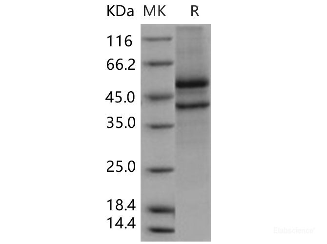 Recombinant Human SPOCK1 / Testican 1 Protein (aa 21-429, His tag)-Elabscience