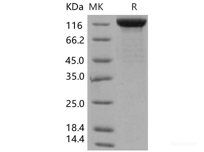 Recombinant Human LIFR / CD118 Protein (His tag)-Elabscience