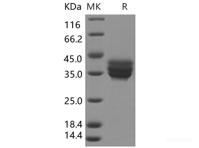 Recombinant Human TNFRSF17 / BCMA / CD269 Protein (Fc Tag)-Elabscience