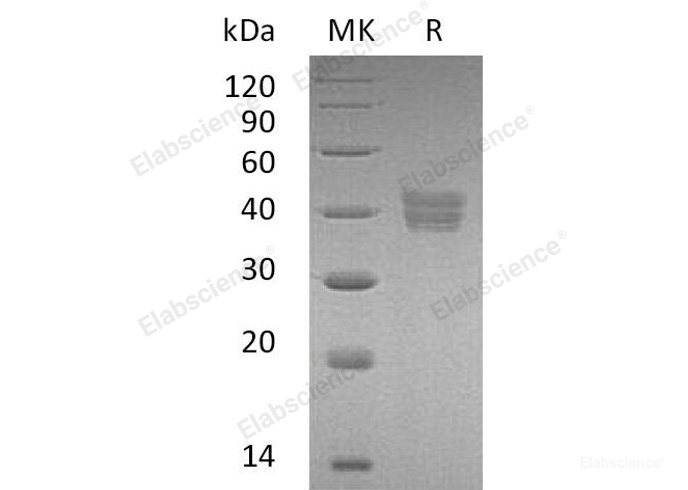 Recombinant Human HtrA2 / Omi Protein (His Tag)-Elabscience