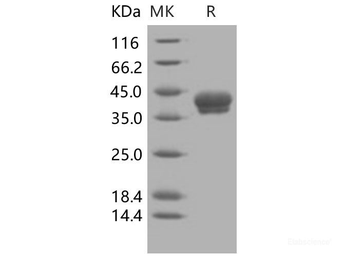 Recombinant Human Carbonic Anhydrase XII / CA12 Protein (His tag)-Elabscience