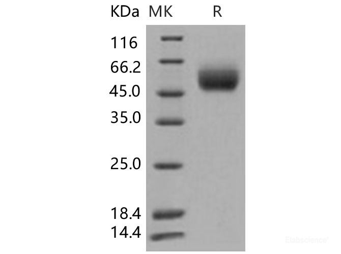 Recombinant Human FGFR1 / CD331 Protein (His tag)-Elabscience