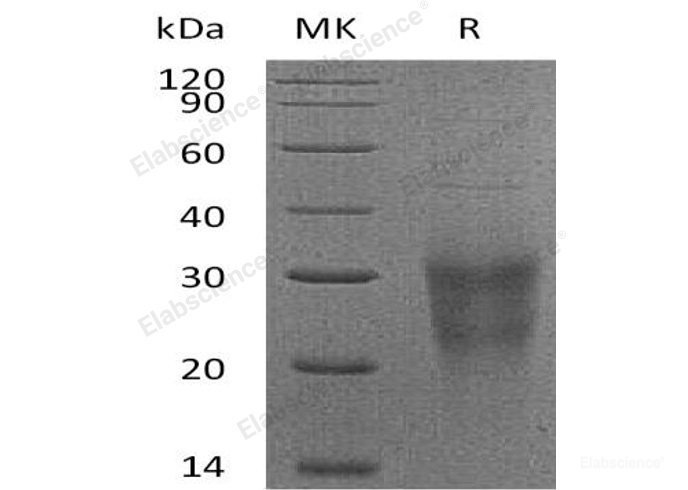 Recombinant Human NKG2D Protein (aa 78-216, His Tag)-Elabscience