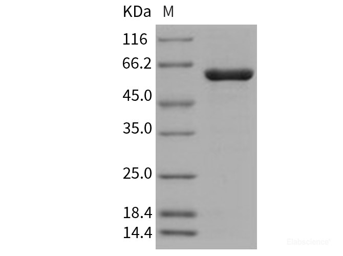 Recombinant Human PTPN2 / TC-PTP Protein (aa 1-314, His & GST tag)-Elabscience