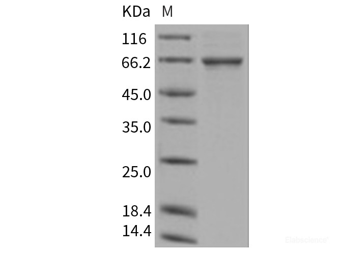 Recombinant Human TGFBI / BIGH3 Protein (His tag)-Elabscience